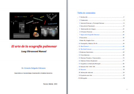 Manual " El Arte de la Ecografía Pulmonar"